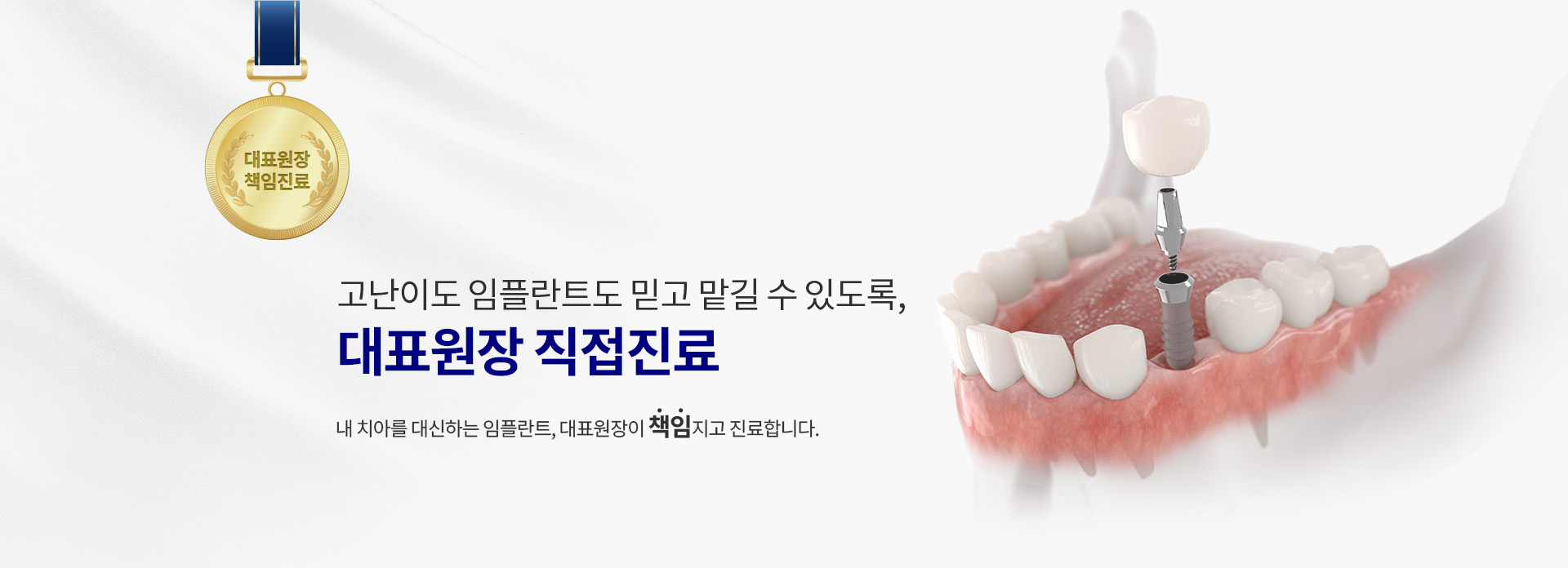 임플란트_2_직접진료