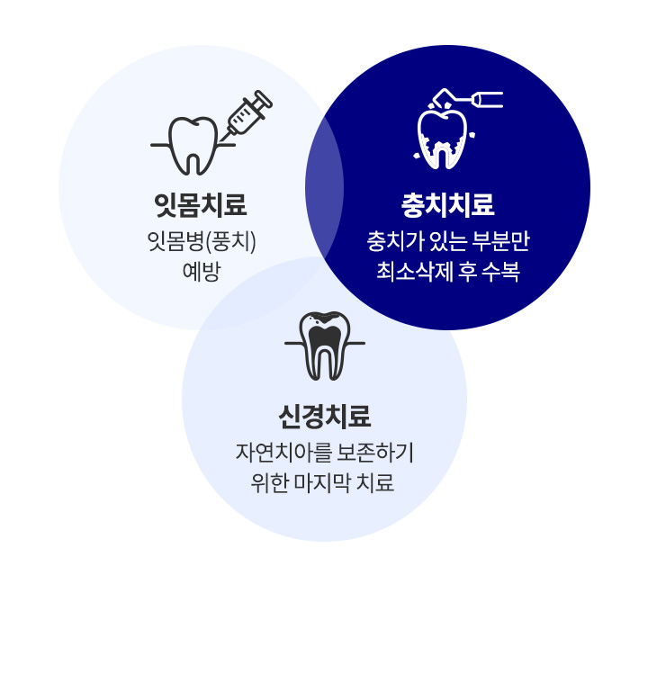 자연치아 살리기_2_자연치아 보존치료