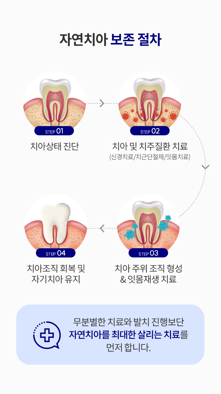 자연치아 살리기_3_절차