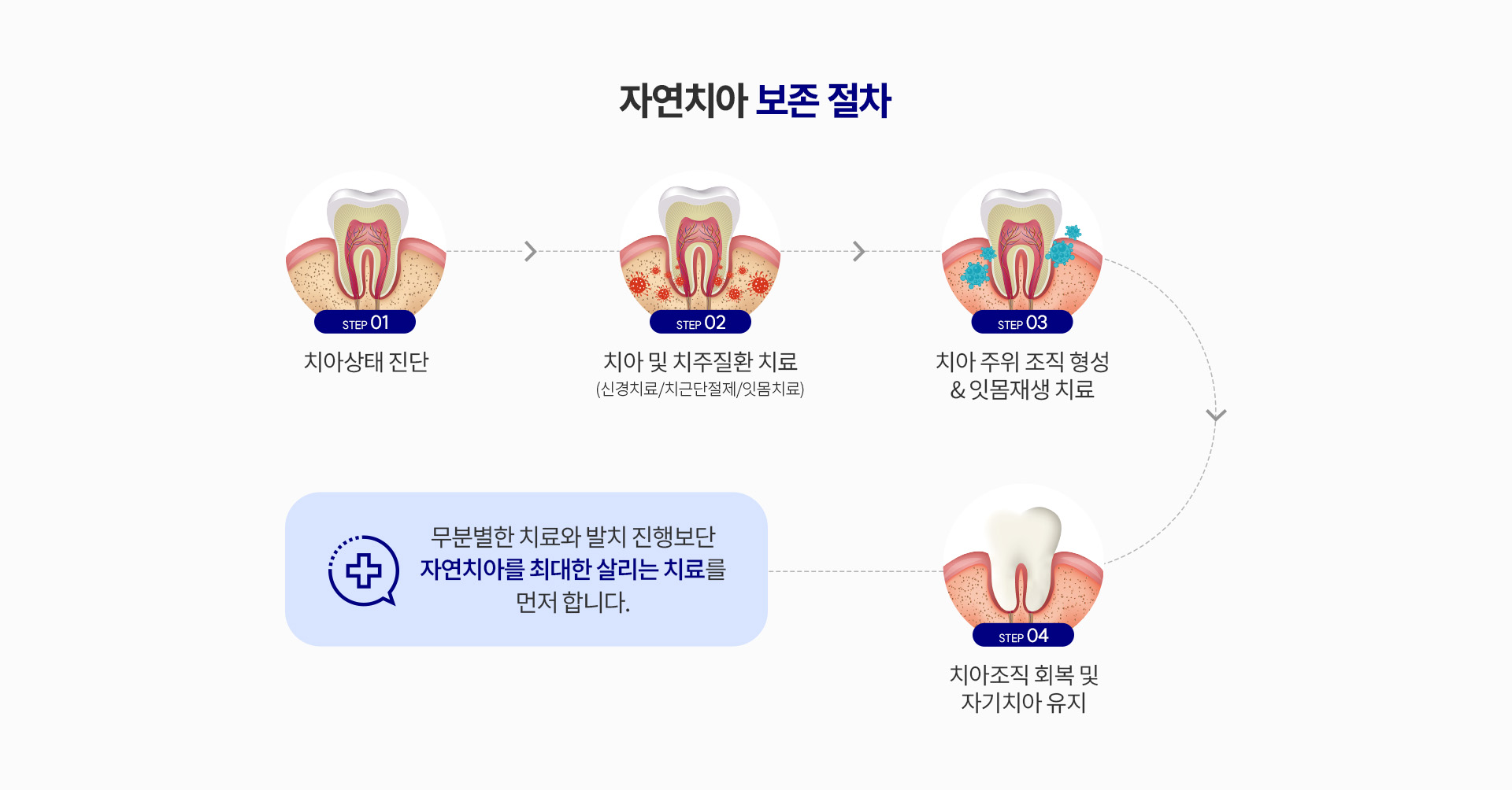 자연치아 살리기_3_절차