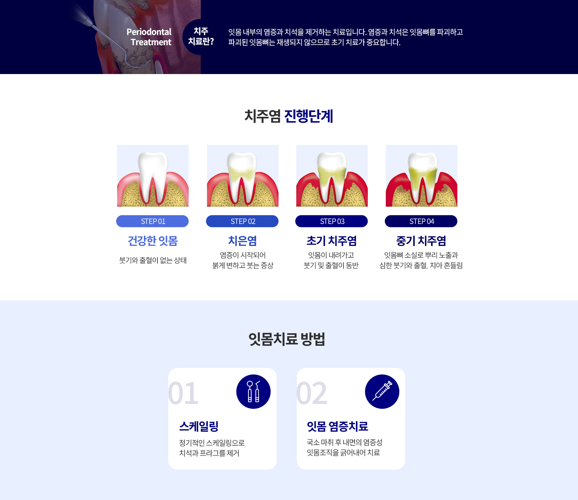 03_자연치아 살리기_4_치주치료