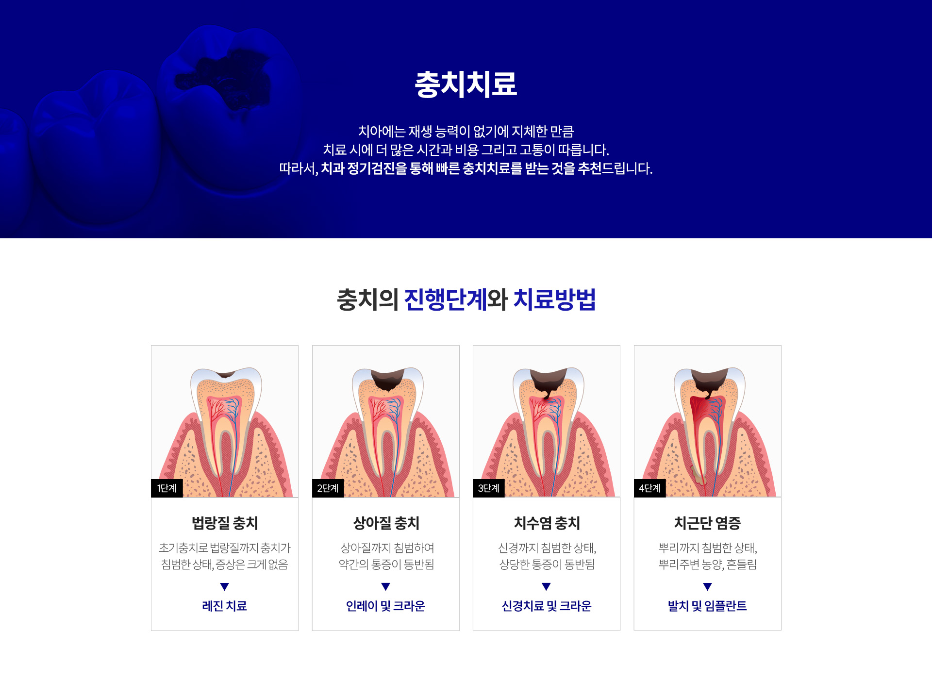 03_자연치아 살리기_5_충치치료
