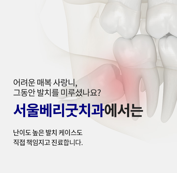 사랑니 발치_2_사랑니